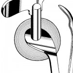 Blade For Keyes Ring Cutter (06-4150) with Brass Bushings Attached